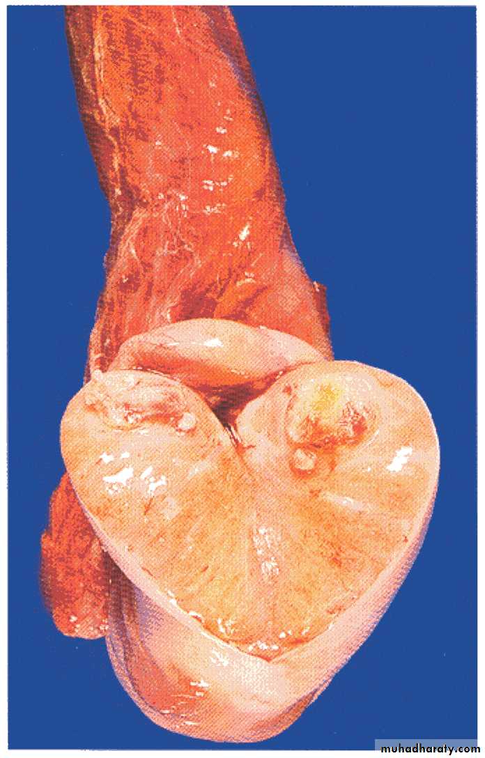 Male Reproductive System