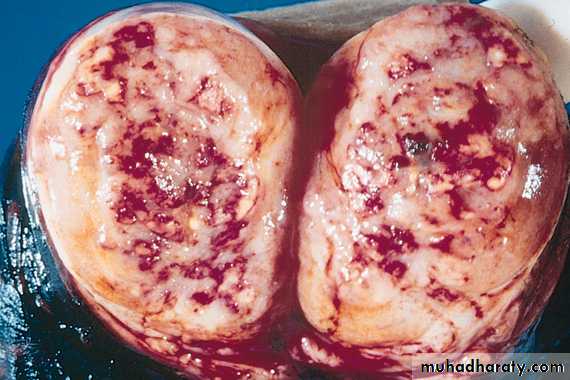 Male Reproductive System