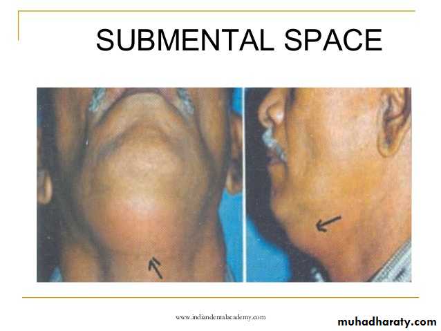 Fascial spaces