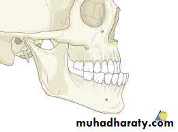 cl III malocclusion