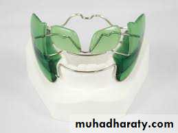 cl III malocclusion