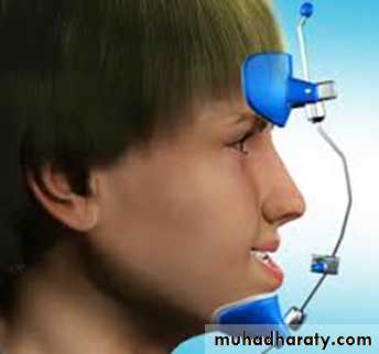 cl III malocclusion