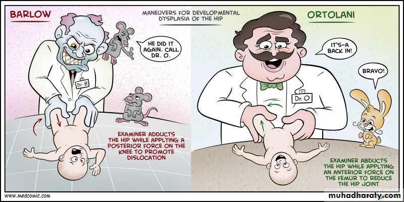 Developmental dysplasia of the hip