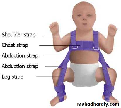 Developmental dysplasia of the hip