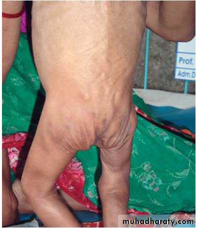 Gastrointestinal tract