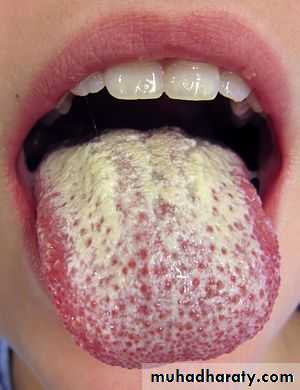 Hematology