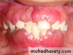 Hematology