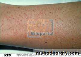 Hematology