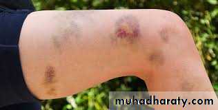 Hematology