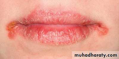 Hematology