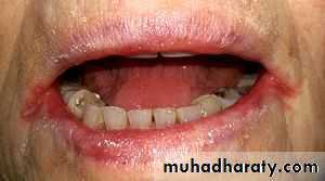 Hematology