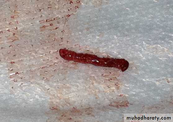 Hematology