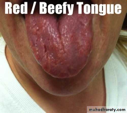 Hematology