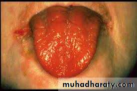Hematology