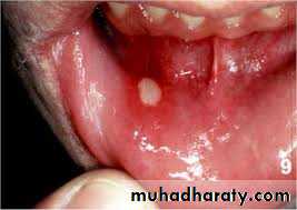 Hematology