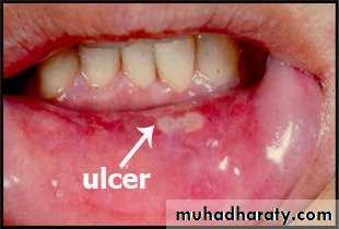 Hematology