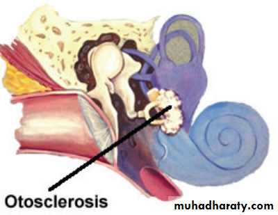 Middle Ear