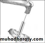 Middle Ear