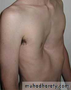 Chest surgery