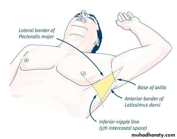 Chest surgery