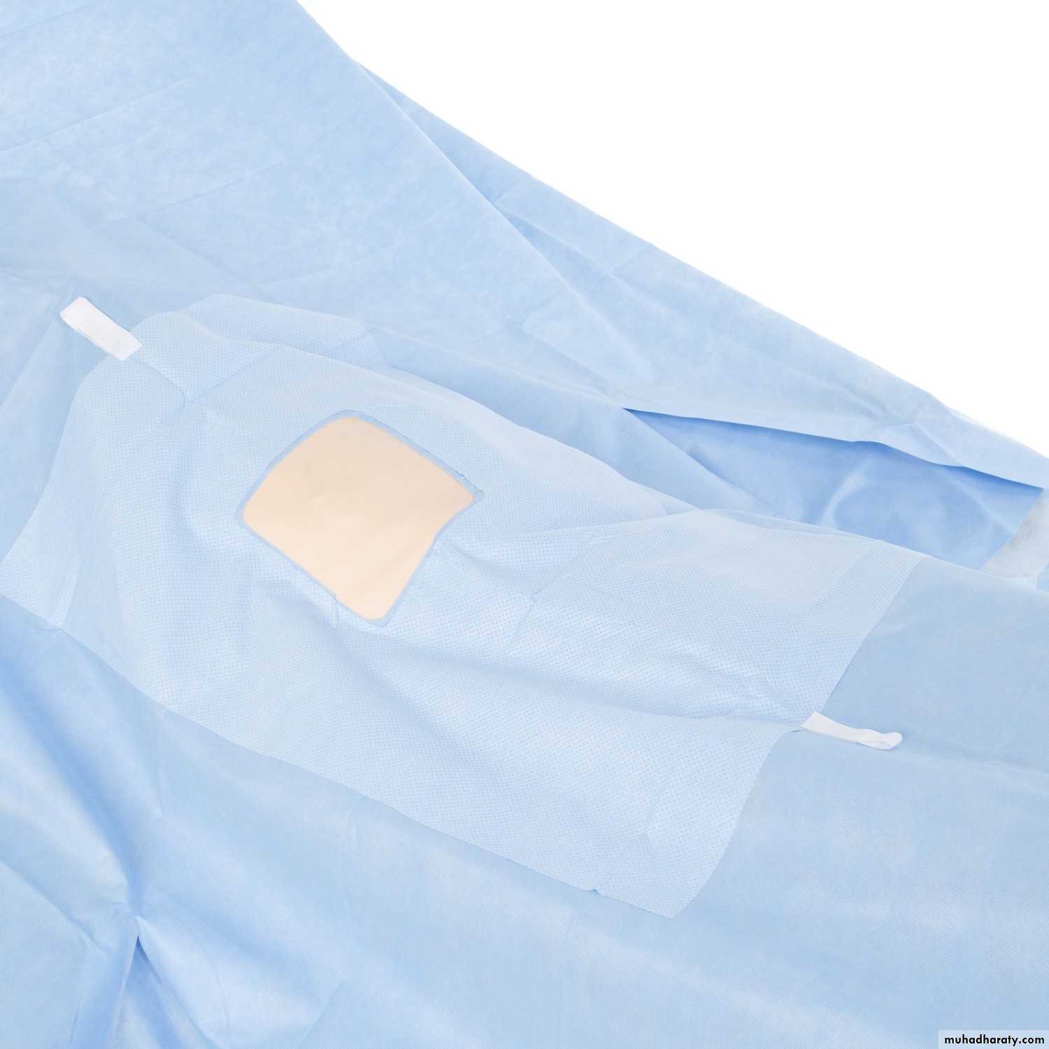 Chest surgery
