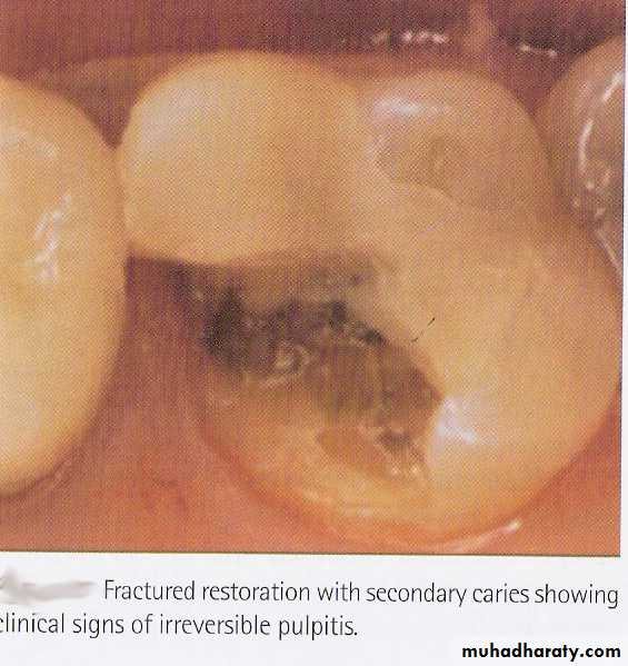 endodontic emergencies