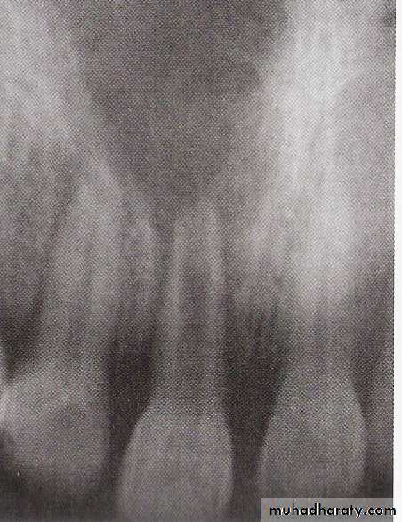 endodontic emergencies