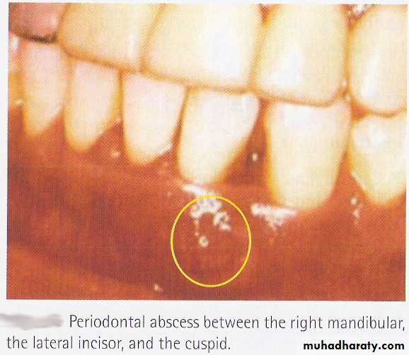 endodontic emergencies