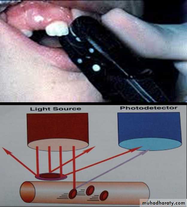 endodontic emergencies