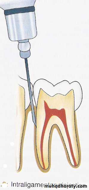 endodontic emergencies