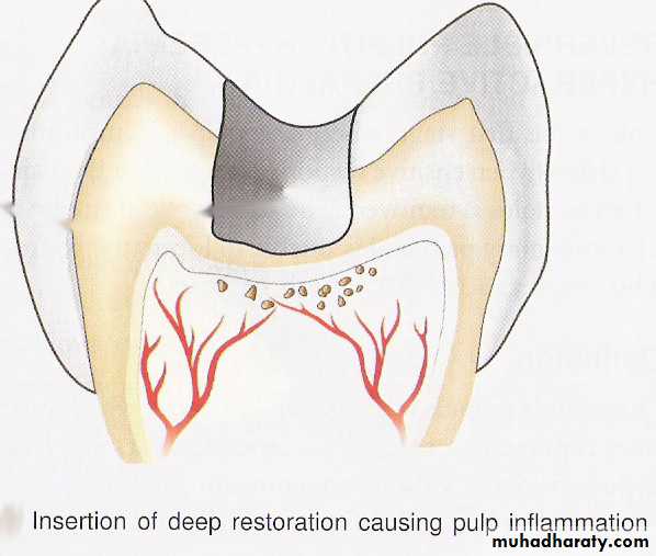 endodontic emergencies