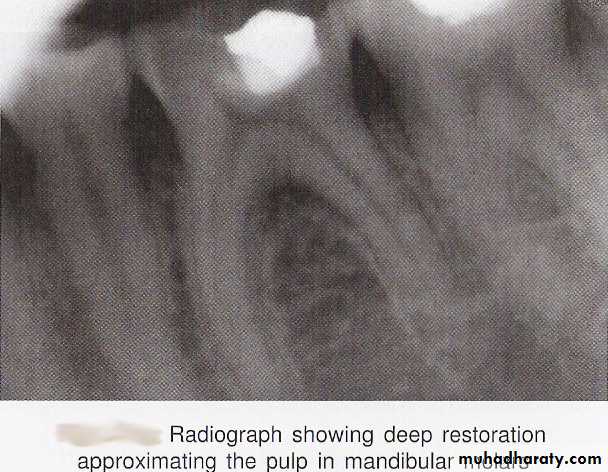 endodontic emergencies
