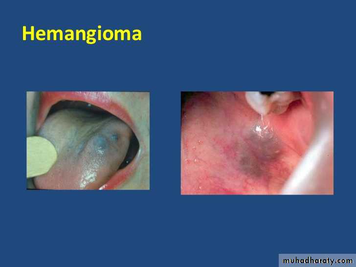 benign tumor and tumor like lesion