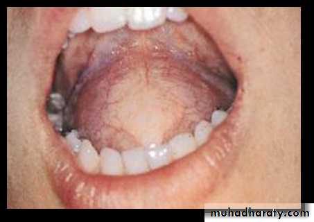 benign tumor and tumor like lesion