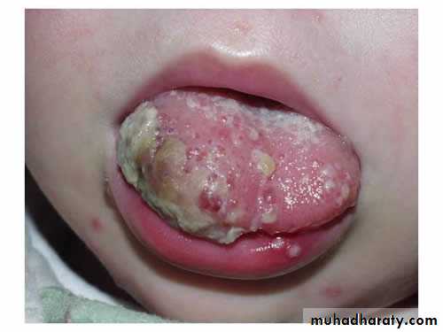 benign tumor and tumor like lesion