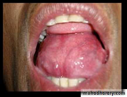 benign tumor and tumor like lesion