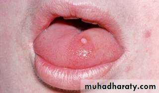 benign tumor and tumor like lesion