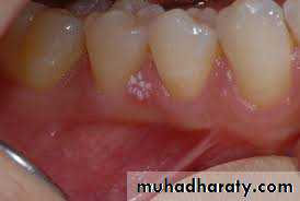benign tumor and tumor like lesion