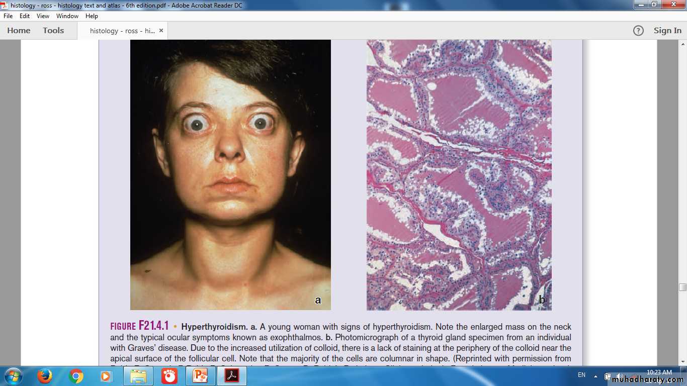 Endocrine histology