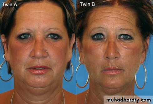 light related disorder