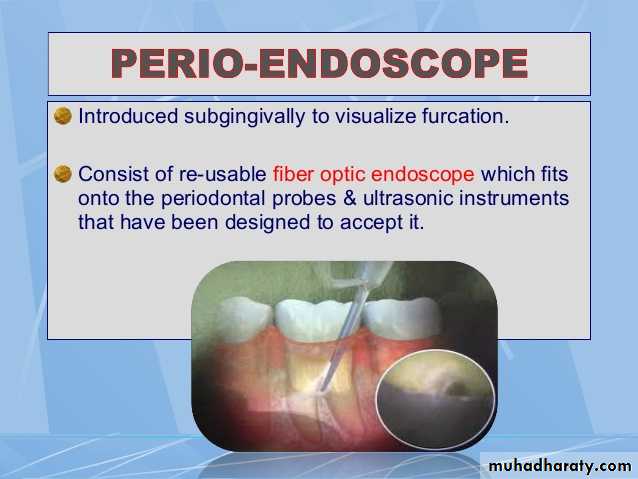 furcation involvement