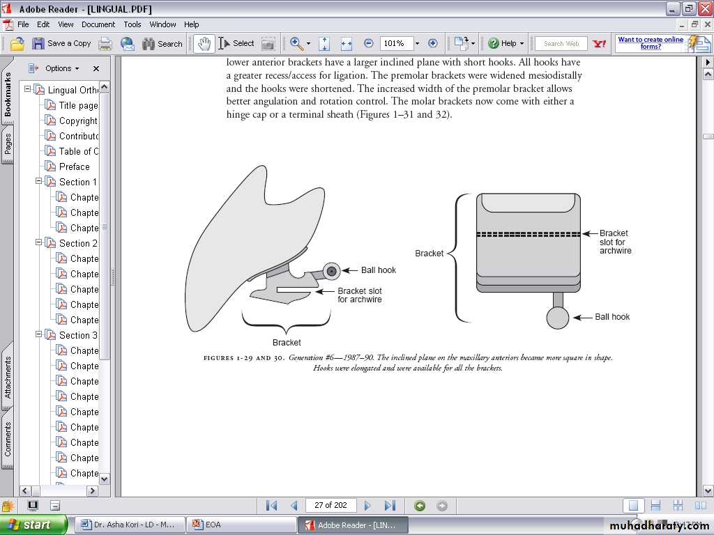 lingual orthodontic