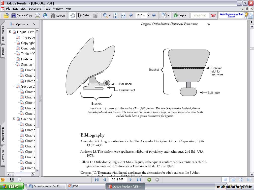 lingual orthodontic