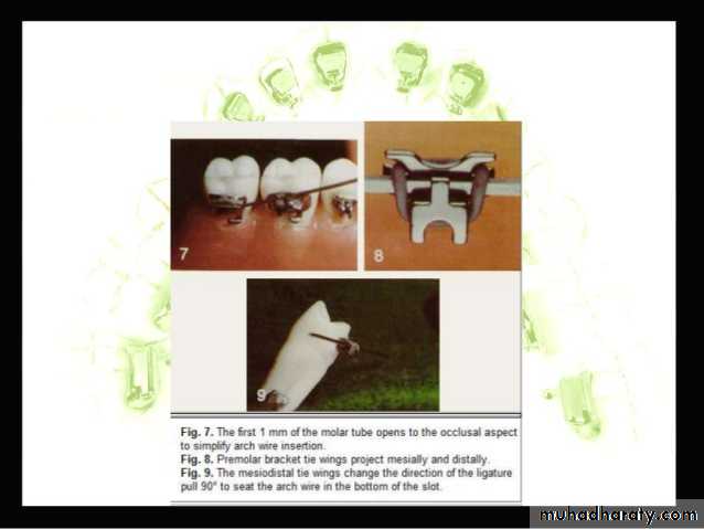 lingual orthodontic