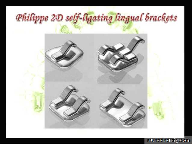 lingual orthodontic