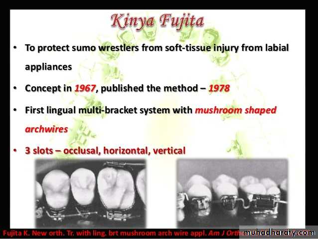 lingual orthodontic