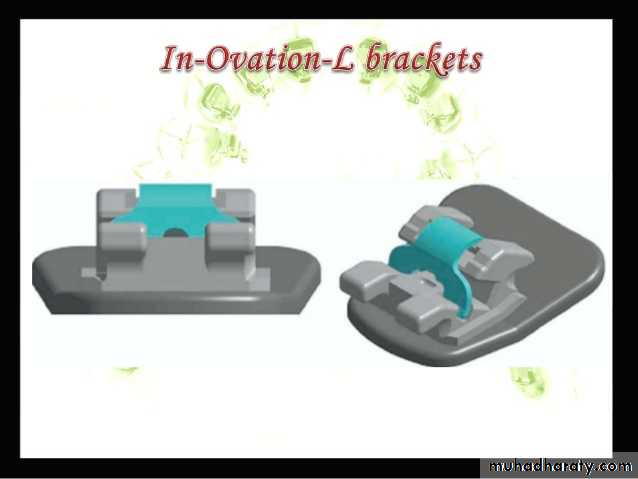 lingual orthodontic