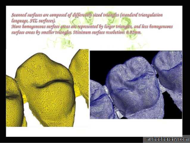 lingual orthodontic