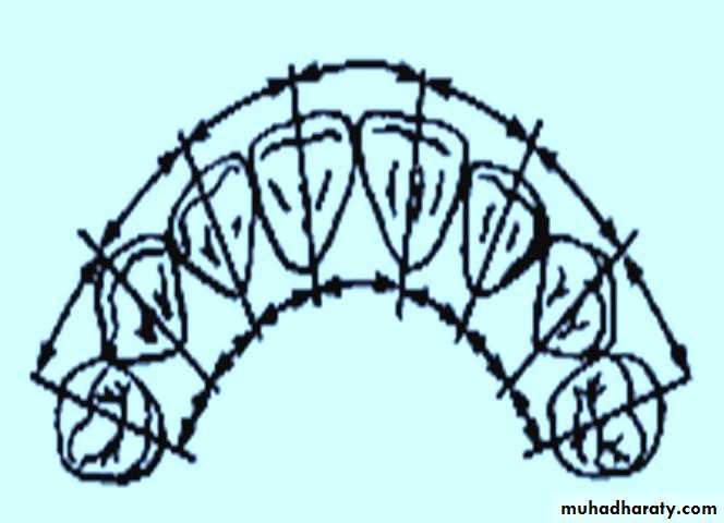 lingual orthodontic