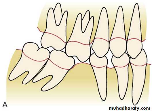 adult orthodontics LEC